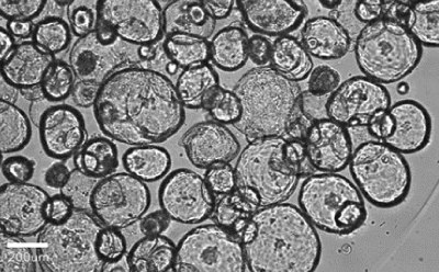 Organoids imaged using Millicell<sup>®</sup> DCI Brightfield image showing round organoids of various sizes, with 200 µm bar for scale.