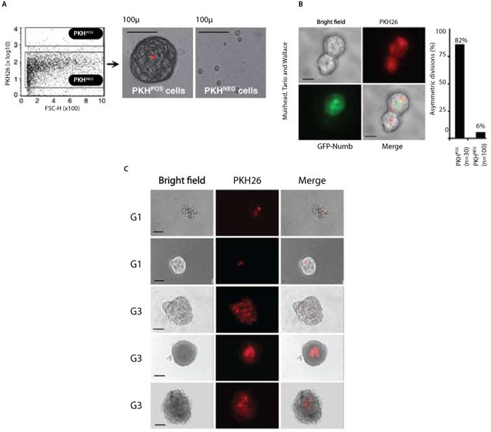 cell-tracking-figure-5 Less differentiated human breast tumors