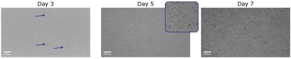 MDCK II Cells Grown on Millicell® 1.0 μm Clear Inserts Microscopy images of MDCK II cells grown on Millicell® 1.0 μm clear inserts over 7 days