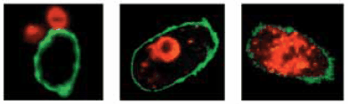 confocal Confocal assay for phagocytosis