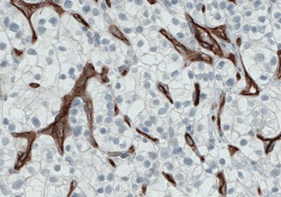 Immunohistochemical staining of Endoglin/CD105 in the human blood vessels using Anti-ENG monoclonal antibody Immunohistochemical staining of Endoglin/CD105