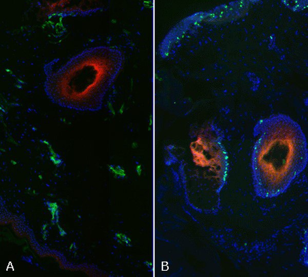 hypoxia-detection-in-fixed-tissue Hypoxia detection in fixed tissue.