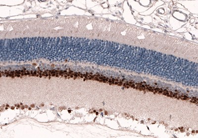 ihc-rat-retina Adult Rat Retina