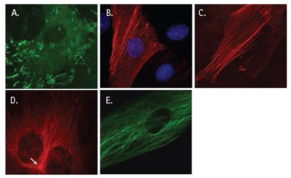 LentiBrite™ lentiviral biosensors localize to specific cytoskeletal elements. (A) GFP-paxillin highlights focal adhesions in REF-52 cells. (B) α-actinin-RFP in REF-52 cells displays a striated filamentous pattern corresponding to actin microfilament cross-link sites. (C) β-actin-RFP in REF-52 cells displays a similar filamentous pattern to that of α-actinin, but with a pattern of continuous intensity. (D) RFP-α-tubulin in HUVECs displays a pattern of microtubule filaments radiating from the microtubule organizing center (white arrow). (E) GFP-vimentin in human MSCs highlights the intermediate filaments. LentiBrite™ lentiviral biosensors localize to specific cytoskeletal elements