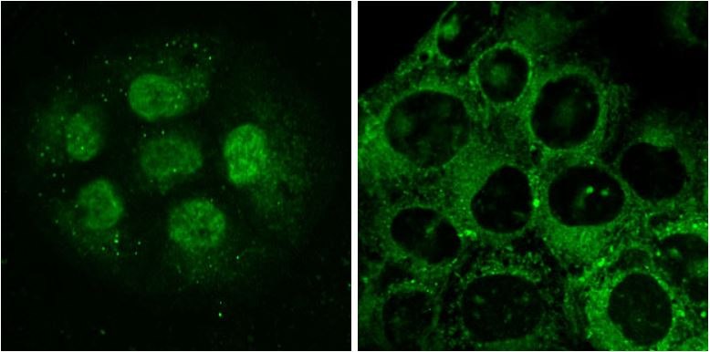 Fluorescent Retinoid Probes LightOx Left and Right Image