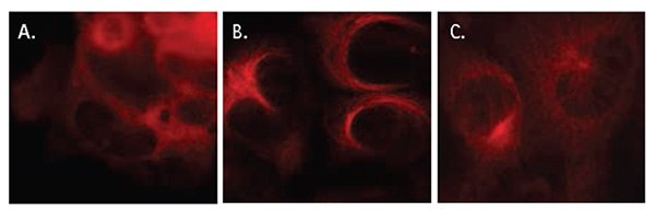 Localization of RFP-tagged tubulin following modulator treatment. HUVECs were lentivirally transduced with RFP-tubulin biosensors at an MOI of 40. Transduced cells were subjected to the following treatments for 4 h: (A) untreated, (B) treated with 1 μM paclitaxel, or (C) treated with 25 μM nocodazole. Cells were fixed, mounted, and imaged by wide-field fluorescence microscopy. Cells treated with paclitaxel displayed bundled microtubules that curved around the nucleus, whereas cells treated with nocodazole contained no evident microtubule structures. Localization of RFP-tagged tubulin following modulator treatment