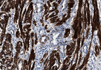 Immunohistochemical staining of smooth muscle cell (SMC) showing high expression of Transgelin using Anti-TAGLN polyclonal antibody Immunohistochemical staining of smooth muscle cell (SMC)