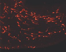 Young Migrating Neurons Labeled with PKH26 Young Migrating Neurons Labeled