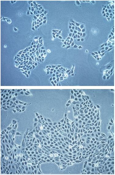 Using Immortalized 16HBE14o- Human Bronchial Epithelial Cell Lines to Model Respiratory Lung Diseases 16HBE14o- cell line-High density human bronchial epithelial cells