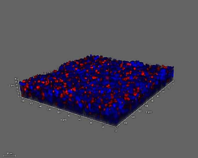 Using Immortalized 16HBE14o- Human Bronchial Epithelial Cell Lines to Model Respiratory Lung Diseases ACE2 DAPI