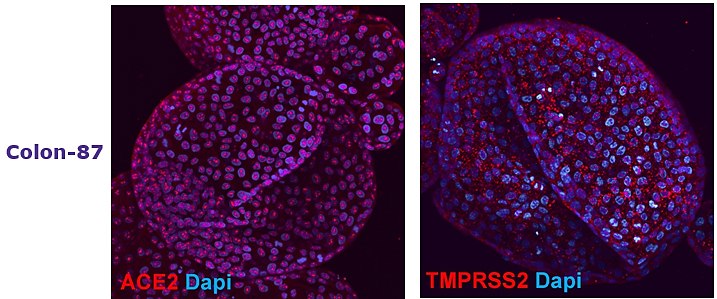 Adult tissue derived colon (SCC321, Colon-87) Adult tissue derived colon (SCC321, Colon-87) and duodenum (SCC320, DUO-85) organoids express SARS-CoV-2 related proteins ACE2 and TMPRSS2.