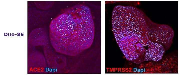 Adult tissue derived duodenum (SCC320, DUO-85) Adult tissue derived colon (SCC321, Colon-87) and duodenum (SCC320, DUO-85) organoids express SARS-CoV-2 related proteins ACE2 and TMPRSS2.