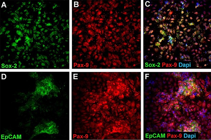 anterior-foregut-endoderm-marker-expression anterior-foregut-endoderm-marker-expression