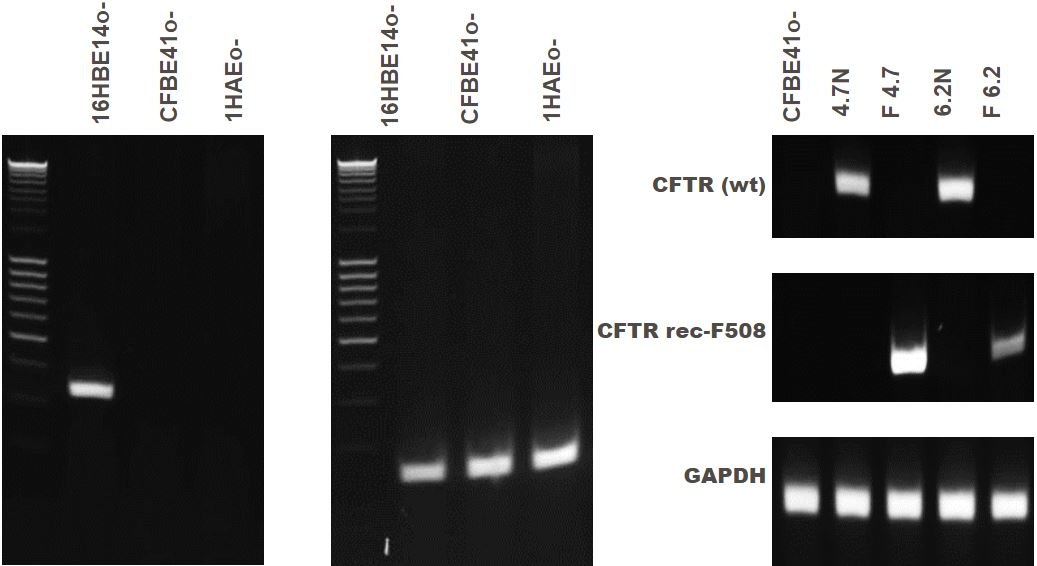 Using Immortalized 16HBE14o- Human Bronchial Epithelial Cell Lines to Model Respiratory Lung Diseases CFTR gene expression of bronchial epithelial cell lines.