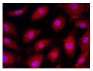 : <a href="/product/sigma/H2165">Cat. No. H2165</a>: Immunofluorescence of HUVEC cells using HK2 (416-429) (RB), <a href="/product/sigma/H2165">Cat. No. H2165</a> (red) at a 1:100 dilution, taken at 40× magnification and nuclear staining with Hoescht 33342 (blue). Yale HTCB IF procedure used. Anti-HK2 (416-429)