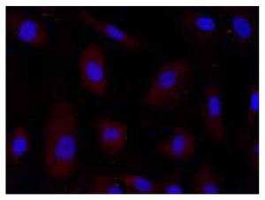 : <a href="/product/sigma/G5672">Cat. No. G5672</a>: Immunofluorescence of HUVEC cells using PGAM2 (38-50) (RB), <a href="/product/sigma/G5672">Cat. No. G5672</a> (red) at a 1:100 dilution, taken at 40× magnification and nuclear staining with Hoescht 33342 (blue). Yale HTCB IF procedure used. Anti-PGAM2