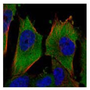 : <a href="/product/sigma/HPA029501">Cat. No. HPA029501</a>: Immunofluorescent staining of human cell line U-251MG shows positivity in cytoplasm. Anti-PKM2