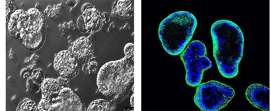 Apical out gut organoids Fluorescent and contrast imaging of apical out gut organoids