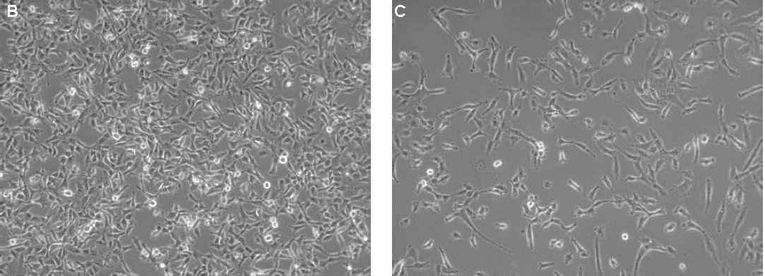 Serum free cancer cell line media Morphology of HT1080 fibrosarcoma cells cultured in Cancer Cell Line Medium XF compared toconventional FBS containing culture conditions