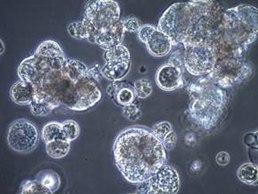 Cells in suspension may attach to one another and form clumps for a variety of reasons Cells in suspension may attach to one another and form clumps for a variety of reasons