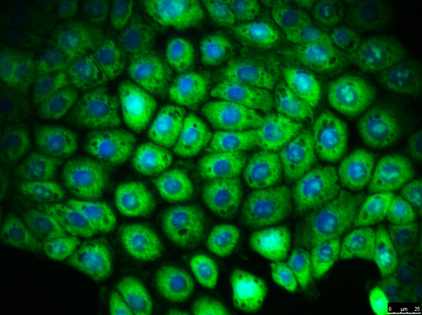 Using Immortalized 16HBE14o- Human Bronchial Epithelial Cell Lines to Model Respiratory Lung Diseases CFTR (WT)