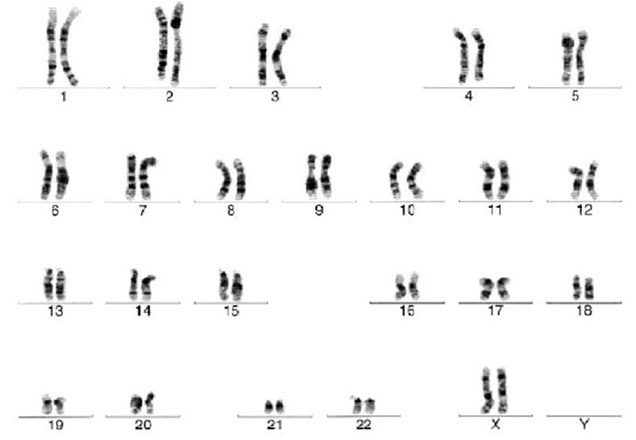 Cytogenetic analysis reveals a normal karyotype for H7 human embryonic stem cells. Cytogenetic analysis reveals a normal karyotype for H7 human embryonic stem cells.