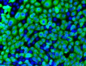 Using Immortalized 16HBE14o- Human Bronchial Epithelial Cell Lines to Model Respiratory Lung Diseases Cytokeratin 18