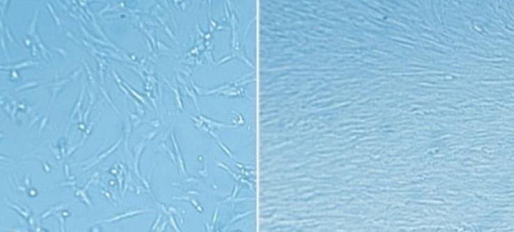 Extracellular matrix (ECM) coating enables rapid expansion of fetal lung fibroblasts. MRC-5 cells derived from human fetal lung fibroblasts were grown for 24 hours after plating on tissue culture plastic without (left) and coated with (right) <a href="/technical-documents/technical-article/cell-culture-and-cell-culture-analysis/3d-cell-culture/extracellular-matrix">extracellular matrix gel</a> to enhance attachment. ECM matrix coating enables rapid expansion of fetal lung fibroblasts