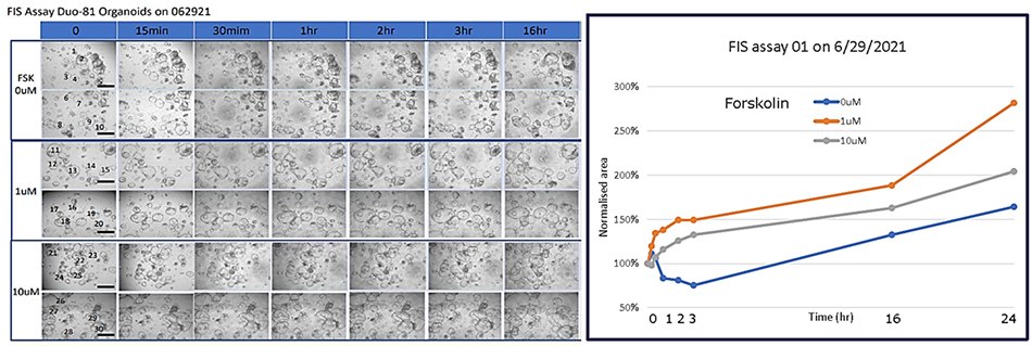 Forskolin-induced swelling assay Forskolin-induced swelling of duodenum gut organoids.