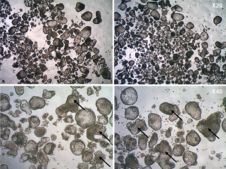 human-lung-bud-organoids-in-suspension-cultures human-lung-bud-organoids-in-suspension-cultures