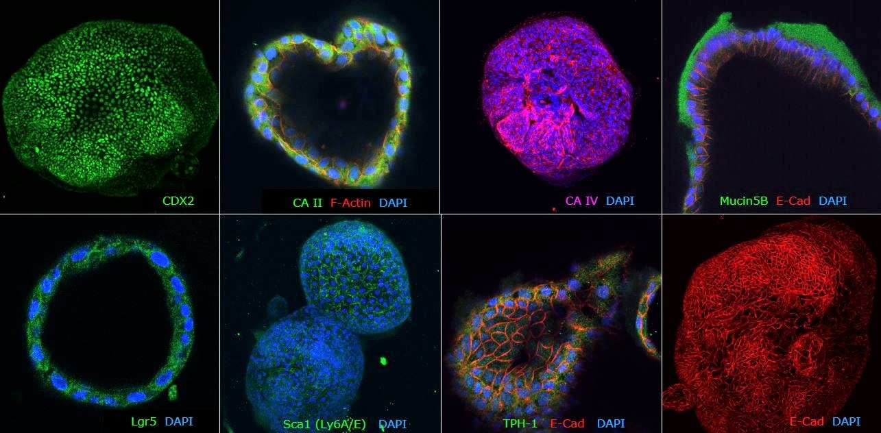 Immunocytochemical characterization of human colon organoids (Colon-87, SCC321). Human colon PDOs are positive for colon-specific markers: CA II, CA IV and Mucin5B, posterior hindgut marker: CDX2, stem cell markers: Lgr5 and Sca1 and epithelial markers: TPH-1 and E-Cad. Immunocytochemical characterization of human colon organoids (Colon-87, SCC321). Human colon PDOs are positive for colon-specific markers: CA II, CA IV and Mucin5B, posterior hindgut marker: CDX2, stem cell markers: Lgr5 and Sca1 and epithelial markers: TPH-1 and E-Cad.