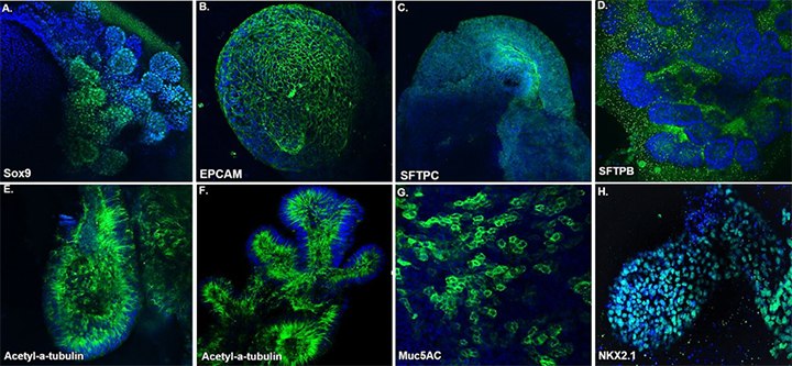 lung-organoid-marker-expression lung-organoid-marker-expression