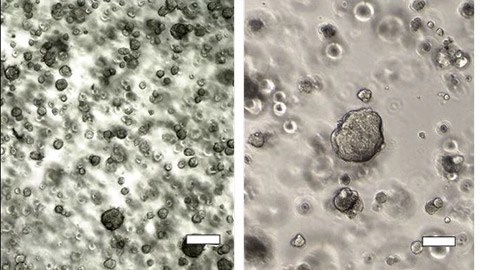 Lung cancer organoid cultured in 3D vs. native tissue Histological and morphological comparison of acinar/papillary 3dGro™ human lung organoids