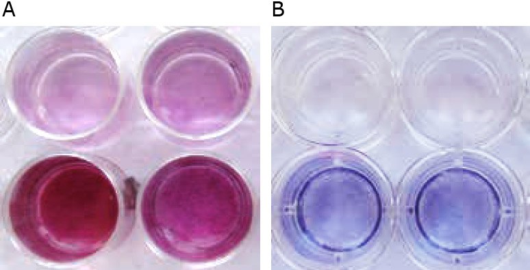 Differentiation of Primary Human Osteoblasts Macroscopic appearance of HOB after mineralization in vitro