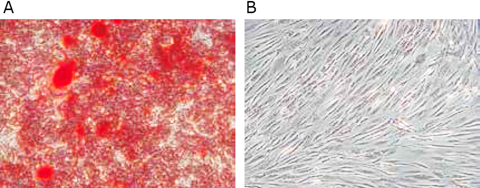 microscopic-appearance-of-hob microscopic-appearance-of-hob