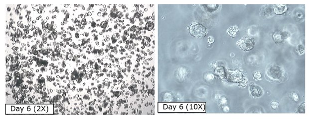 Microscopy images of PDAC organoids before cryopreservation. The first image shows organoids at Day 6 at 2X magnification, with small black circles covering the entirety of the image. The second image shows organoids at Day 6 at 10X magnification, with larger clear circles on a grey background. 