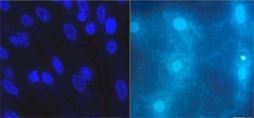 Agentes habituales de detección de ADN como el DAPI o Hoechst revelan la presencia de micoplasmas en cultivos contaminados (derecha) utilizando el microscopio de fluorescencia. Agentes habituales de detección de ADN como el DAPI o Hoechst revelan la presencia de micoplasmas en cultivos contaminados (derecha) utilizando el microscopio de fluorescencia.