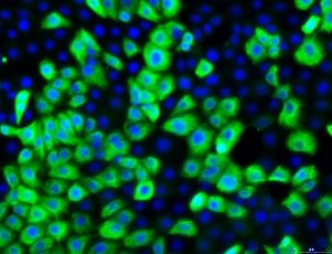 Using Immortalized 16HBE14o- Human Bronchial Epithelial Cell Lines to Model Respiratory Lung Diseases Pan-Cytokeratin