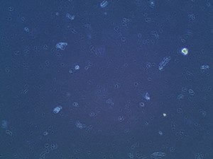 Precipitation from brand new calf serum Precipitation from brand new calf serum