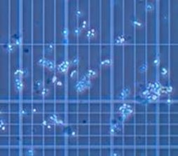 Cells in suspension may attach to one another and form clumps for a variety of reasons Cells in suspension may attach to one another and form clumps for a variety of reasons