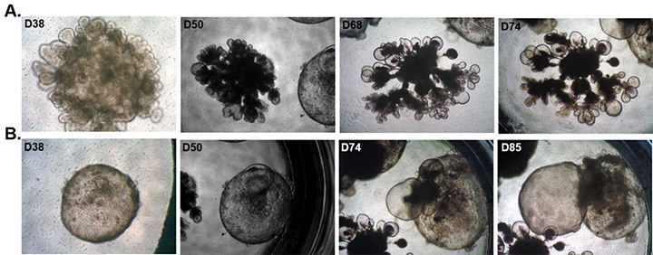 time-course-human-lung-organoid-maturation time-course-human-lung-organoid-maturation