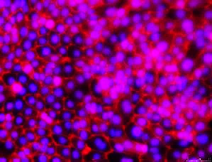 Using Immortalized 16HBE14o- Human Bronchial Epithelial Cell Lines to Model Respiratory Lung Diseases ZO-1 Tight Junctions