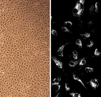 Bovine Aortic Endothelial Cells (BAOEC) Bovine Aortic Endothelial Cells (BAOEC)