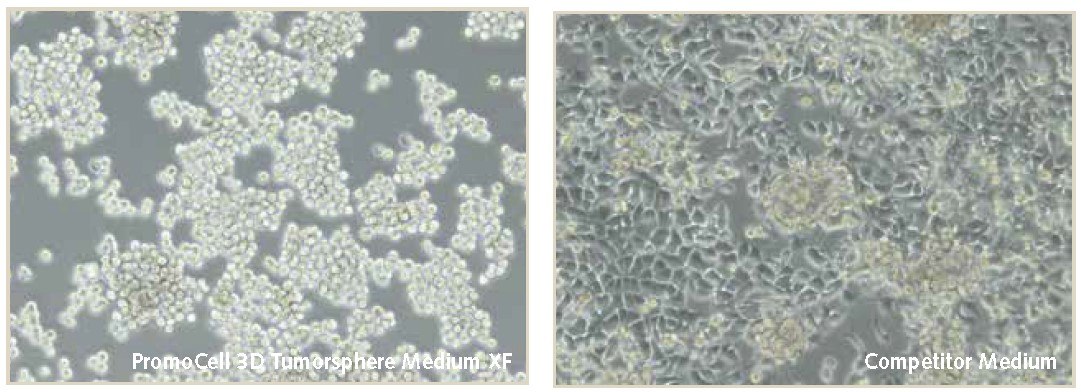 cell-morghology Cell morghology of MDA-MB-231 breast cancer cells during 3D mammosphere culture.