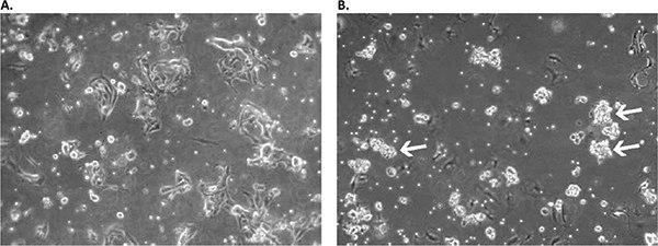 Microsoft Word - Promocell Primary Cancer Cell Media ACF Tech Article (9) Appearance of primary culture of lung squamous cell carcinoma cells in the Primary Cancer Cell Medium D-ACF in early stages.