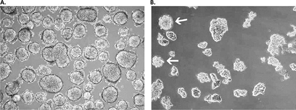 primary-culture Primary culture derived from a low-grade small cell lung cancer with the Primary Cancer Culture System.