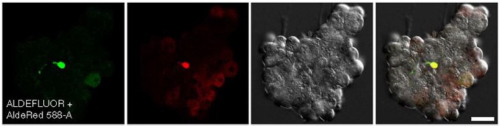 Confocal images of CA/TD murine pancreatic cells co-stained with ALDEFLUOR™ and AldeRed™ 588-A. CA/TD murine pancreatic cells co-stained with ALDEFLUOR and AldeRed 588-A