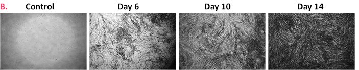 Differentiation of multiple MSC cell lines using (A) (i) OsteoMAX-XF™ Differentiation Medium; (ii) Supplier LT Osteogenic Differentiation Kit. Differentiation was induced over 21 days in 48-well plate cultures of four different human MSC cell lines. Alizarin Red staining of representative wells at day 7, 14 and 21 are shown. B) Mineralization kinetics of human bone-marrow derived MSC (SCC034) differentiated in OsteoMAX-XF™ Medium. Differentiation of multiple MSC cell lines