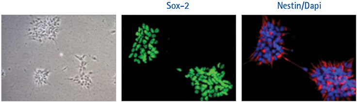 ENStem™-A neural progenitor cells grown for 3 passages in HumanKine® Thermostable bFGF following a normal feeding regimen display proper morphology and express the neural stem cell markers Sox-2 and Nestin. Nestin-stained cells were counterstained with DAPI (blue) nuclear stain. ENStem™-A neural progenitor cells grown for 3 passages in HumanKine®