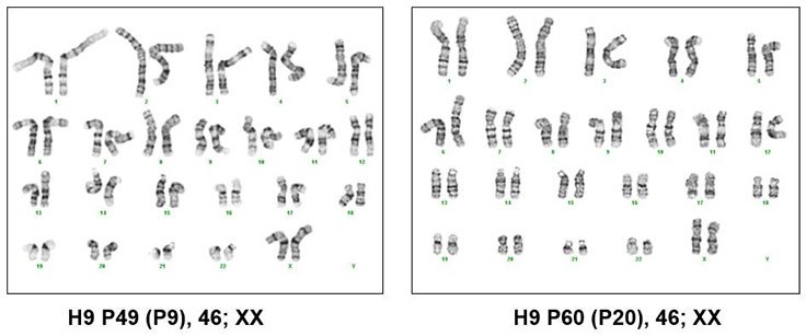H9 human ES cells maintained using an every-other-day/no weekend feeding schedule in PluriSTEM™ media for 9 and 20 passages have normal female karyotypes. Karyotyping of pluripotent stem cells cultured in PluriSTEM™ media